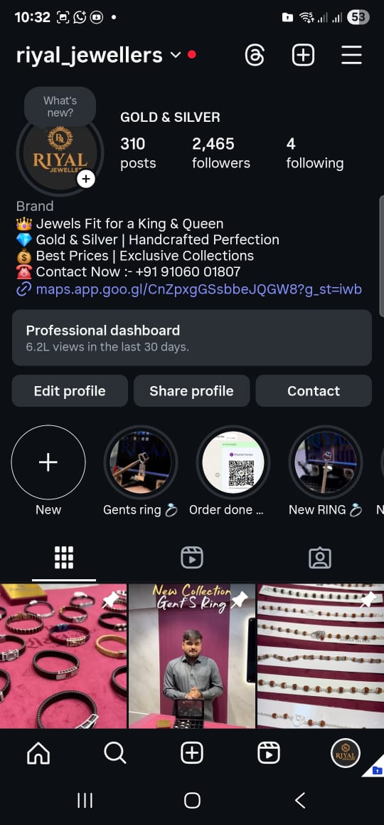 Client 2: Instagram Growth Before